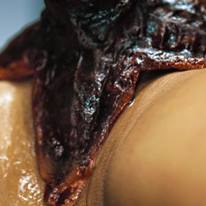 Close up on sucker tentacle