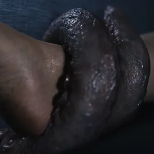 Rikako Katayama's legs are wrapped