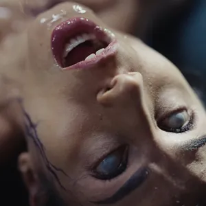 Penny Park gets parasited